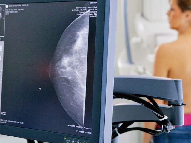 Câncer de mama: oncologista do Hospital de Clínicas orienta sobre o tratamento da doença
