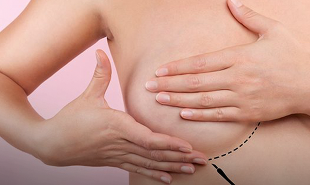 Câncer de mama supera o de pulmão e se torna o mais comum