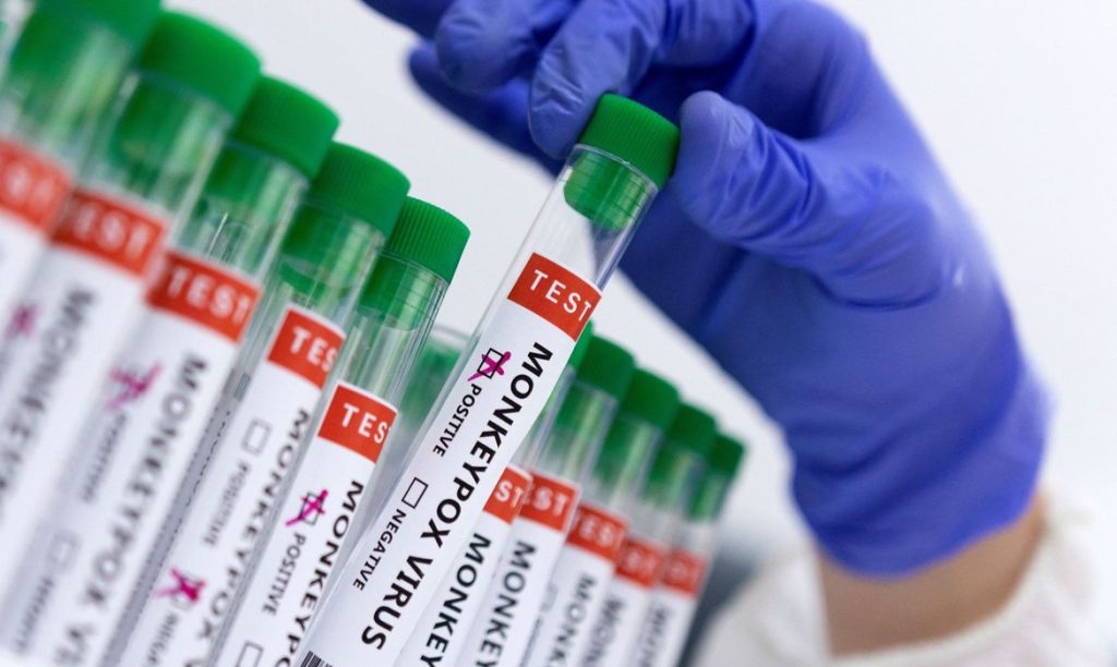 São Paulo confirma segundo caso de varíola dos macacos