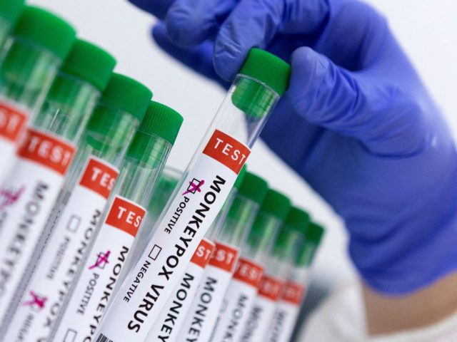 São Paulo confirma segundo caso de varíola dos macacos