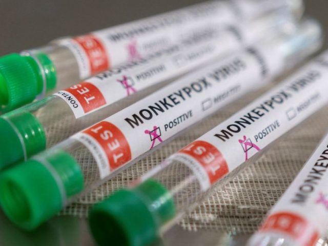 Ministério da Saúde confirma 8º caso de varíola dos macacos no país